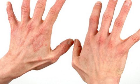 بررسی علائم مختلف بیماری روی دستان